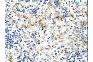 Image no. 1 for anti-Moloney Leukemia Virus 10 (MOV10) (C-Term) antibody (ABIN204954) (MOV10 抗体  (C-Term))