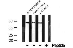 Western blot analysis of extracts from various tissue, using CADM4 antibody. (Cell Adhesion Molecule 4 抗体  (C-Term))