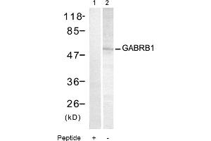 Image no. 1 for anti-gamma-aminobutyric Acid (GABA) A Receptor, Subunit beta 1 (GABRB1) (Ser434) antibody (ABIN319327) (GABRB1 抗体  (Ser434))