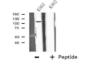 Western blot analysis of extracts from K562 cells, using EPB41L2 antibody. (EPB41L2 抗体  (Internal Region))