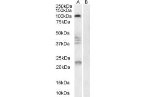 Image no. 1 for anti-Reticulon 4 Receptor (RTN4R) (Internal Region) antibody (ABIN374563) (RTN4R 抗体  (Internal Region))