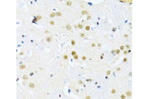 Immunohistochemistry of paraffin-embedded Mouse brain using ITGB3BP Polyclonal Antibody at dilution of 1:100 (40x lens). (ITGB3BP 抗体)