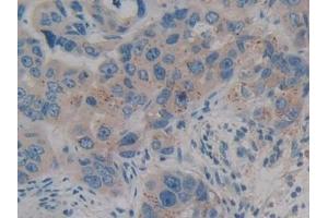 Immunohistochemistry (IHC) image for anti-Cell Death-Inducing DFFA-Like Effector C (CIDEC) (AA 1-251) antibody (ABIN7440137)