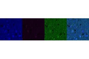 Immunohistochemistry (IHC) image for anti-Cannabinoid Receptor 1 (CNR1) antibody (ABIN7456307) (CNR1 抗体)