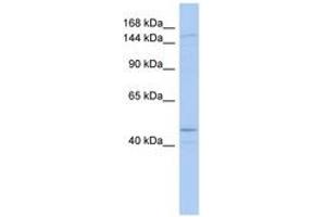 Image no. 1 for anti-Superkiller Viralicidic Activity 2-Like (SKIV2L) (AA 863-912) antibody (ABIN6742676) (SKIV2L 抗体  (AA 863-912))