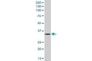 Western Blotting (WB) image for anti-AIMP1 / EMAP II (AA 1-313) antibody (ABIN961494) (AIMP1 / EMAP II (AA 1-313) 抗体)