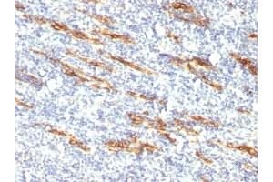 Formalin-fixed, paraffin-embedded human Tonsil stained with CD34 Monoclonal Antibody (QBEnd/10 + HPCA1/763) (CD34 抗体)