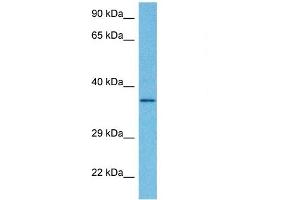 Host:  Rabbit  Target Name:  DHRS7B  Sample Tissue:  Human HepG2 Whole Cell  Antibody Dilution:  1ug/ml (DHRS7B 抗体  (Middle Region))