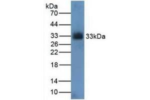 Detection of CDK4 in Rat Kidney Tissue using Polyclonal Antibody to Cyclin Dependent Kinase 4 (CDK4) (CDK4 抗体  (AA 6-295))