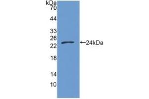 Detection of Recombinant GAS6, Human using Polyclonal Antibody to Growth Arrest Specific Protein 6 (GAS6) (GAS6 抗体  (AA 136-311))