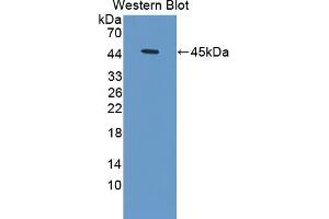 Detection of Recombinant HBd, Human using Polyclonal Antibody to Hemoglobin Delta (HBd) (HBd 抗体  (AA 1-143))