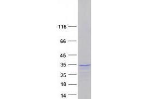 Western Blotting (WB) image for SRY (Sex Determining Region Y)-Box 21 (SOX21) protein (Myc-DYKDDDDK Tag) (ABIN2732453)