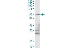 Western Blotting (WB) image for anti-Mahogunin, Ring Finger 1 (MGRN1) (AA 1-576) antibody (ABIN525079)