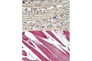 Immunohistochemical staining (Formalin-fixed paraffin-embedded sections) of human skeletal muscle (A, B) with GSTM2 polyclonal antibody . (GSTM2 抗体  (N-Term))