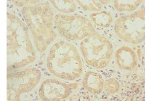 Immunohistochemistry of paraffin-embedded human kidney tissue using ABIN7175224 at dilution of 1:100