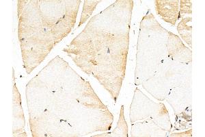 ABIN7094381 and ABIN7098428 at 1/100 staining Mouse muscle tissue by IHC-P. (MYOZ2 抗体  (Internal Region))