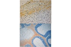 Immunohistochemistry (Paraffin-embedded Sections) (IHC (p)) image for anti-Mitogen-Activated Protein Kinase 8 Interacting Protein 3 (MAPK8IP3) (N-Term) antibody (ABIN1107892) (JIP3 抗体  (N-Term))