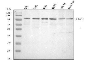 Western blot analysis of Topoisomerase I using anti-Topoisomerase I antibody (ABIN5692844). (Topoisomerase I 抗体  (AA 526-765))