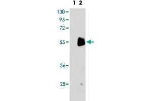Western blot analysis of PRMT7 (arrow) using PRMT7 polyclonal antibody . (PRMT7 抗体  (C-Term))