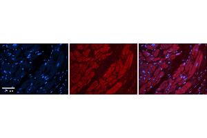 Rabbit Anti-TFB1M Antibody    Formalin Fixed Paraffin Embedded Tissue: Human Adult heart  Observed Staining: Cytoplasmic Primary Antibody Concentration: 1:600 Secondary Antibody: Donkey anti-Rabbit-Cy2/3 Secondary Antibody Concentration: 1:200 Magnification: 20X Exposure Time: 0. (TFB1M 抗体  (N-Term))