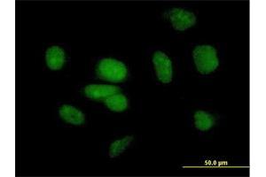 Immunofluorescence of purified MaxPab antibody to PB1 on HeLa cell. (Polybromo 1 抗体  (AA 1-306))