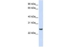 WB Suggested Anti-NKIRAS1 Antibody Titration: 0. (NKIRAS1 抗体  (N-Term))