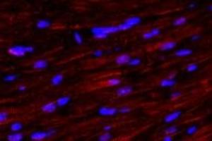 Immunofluorescent analysis of paraformaldehyde-fixed mouse heart using,alpha Actinin (ABIN7073023) at dilution of 1: 500 (alpha Actinin 抗体)
