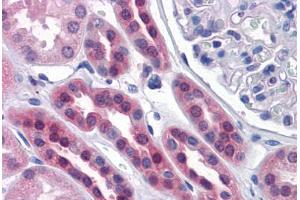 Human Kidney: Formalin-Fixed, Paraffin-Embedded (FFPE) (SDSL 抗体  (AA 1-330))