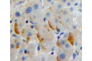 Used in DAB staining on fromalin fixed paraffin-embedded Liver tissue (PCDHb2 抗体  (AA 54-291))