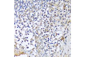 Immunohistochemistry of paraffin-embedded human tonsil using CF antibody (3087) at dilution of 1:100 (40x lens). (A1CF 抗体  (AA 50-120))