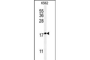 Western blot analysis of KRT1 Antibody (Center) (ABIN651241 and ABIN2840150) in K562 cell line lysates (35 μg/lane). (KRTAP1-1 抗体  (AA 88-117))