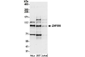 anti-Zinc Finger Protein 598 (ZNF598) (AA 375-425) antibody