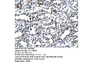 Immunohistochemistry (IHC) image for anti-Capicua Homolog (CIC) (N-Term) antibody (ABIN2779683)
