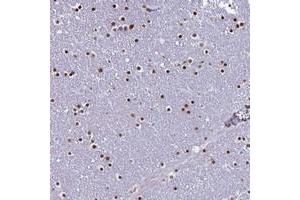 Immunohistochemical staining of human lateral ventricle with LCE6A polyclonal antibody  shows strong nuclear positivity in glial cells. (LCE6A 抗体)