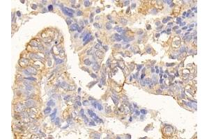 Immunohistochemistry (IHC) image for anti-Keratin 10 (KRT10) (AA 153-456) antibody (ABIN7433948)