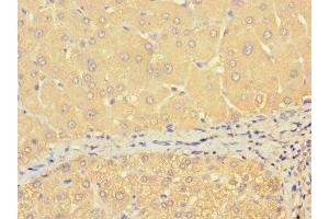 Immunohistochemistry of paraffin-embedded human liver tissue using ABIN7172158 at dilution of 1:100 (THRSP 抗体  (AA 41-144))