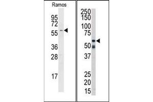 Image no. 1 for anti-Receptor-Interacting Serine-threonine Kinase 2 (RIPK2) (C-Term) antibody (ABIN360158)