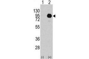 Western Blotting (WB) image for anti-Small Nuclear Ribonucleoprotein Polypeptide E (SNRPE) antibody (ABIN3003509) (SNRPE 抗体)