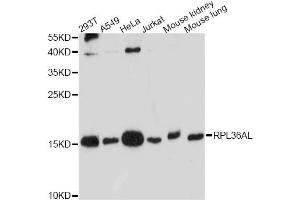 Western blot analysis of extracts of various cell lines, using RPL36AL antibody. (RPL36AL 抗体)