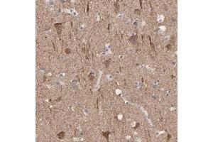 Immunohistochemical staining of human cerebral cortex with CNTN3 polyclonal antibody  shows strong cytoplasmic positivity in neuronal cells at 1:50-1:200 dilution. (CNTN3 抗体)