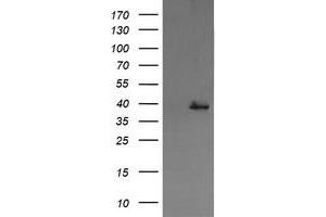 Image no. 1 for anti-Mitogen-Activated Protein Kinase Kinase 3 (MAP2K3) antibody (ABIN1499416) (MAP2K3 抗体)
