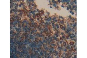 Used in DAB staining on fromalin fixed paraffin- embedded Kidney tissue (CD72 抗体  (AA 143-345))