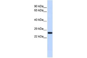 WB Suggested Anti-SOD2 Antibody Titration: 0. (SOD2 抗体  (N-Term))