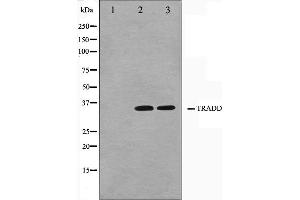 Western blot analysis on COS7 and HuvEc cell lysate using TRADD Antibody.