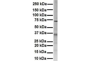 WB Suggested Anti-RHOT1 antibody Titration: 1 ug/mL Sample Type: HEK293 (RHOT1 抗体  (Middle Region))