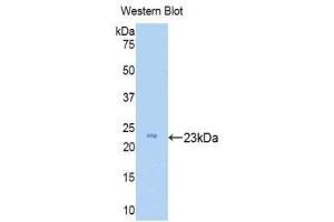 Western Blotting (WB) image for anti-Zyxin (ZYX) (AA 384-572) antibody (ABIN1175612) (ZYX 抗体  (AA 384-572))