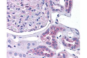 CCL2 antibody was used for immunohistochemistry at a concentration of 4-8 ug/ml. (CCL2 抗体  (Middle Region))