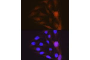 Immunofluorescence analysis of U-2 OS cells using Musashi-1 (MSI1) Rabbit mAb (ABIN7268700) at dilution of 1:100 (40x lens). (MSI1 抗体)