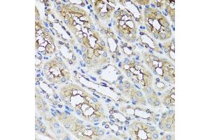 Immunohistochemistry of paraffin-embedded mouse kidney using AIP antibody. (AIP 抗体)