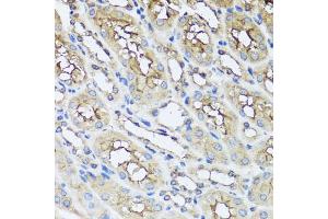 Immunohistochemistry of paraffin-embedded mouse kidney using AIP antibody. (AIP 抗体)